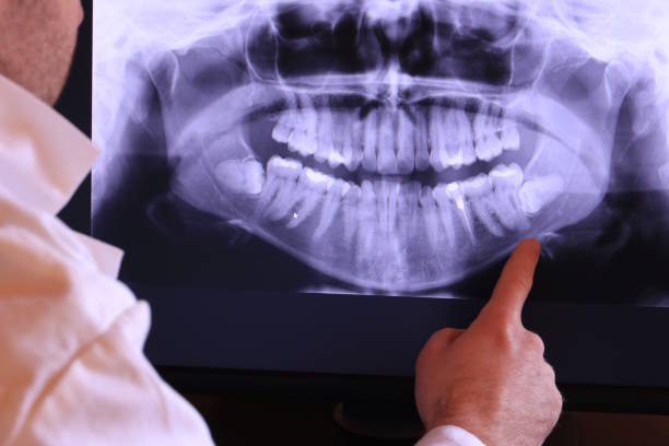 Best Same-Day Emergency Dental Services in Mallory, WV