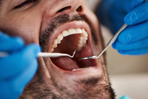Best Emergency Root Canal Treatment in Mallory, WV